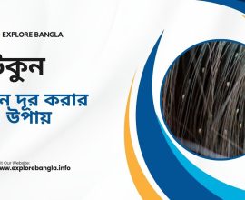 উকুন