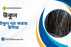 উকুন