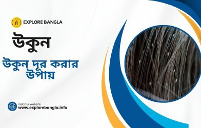 উকুন